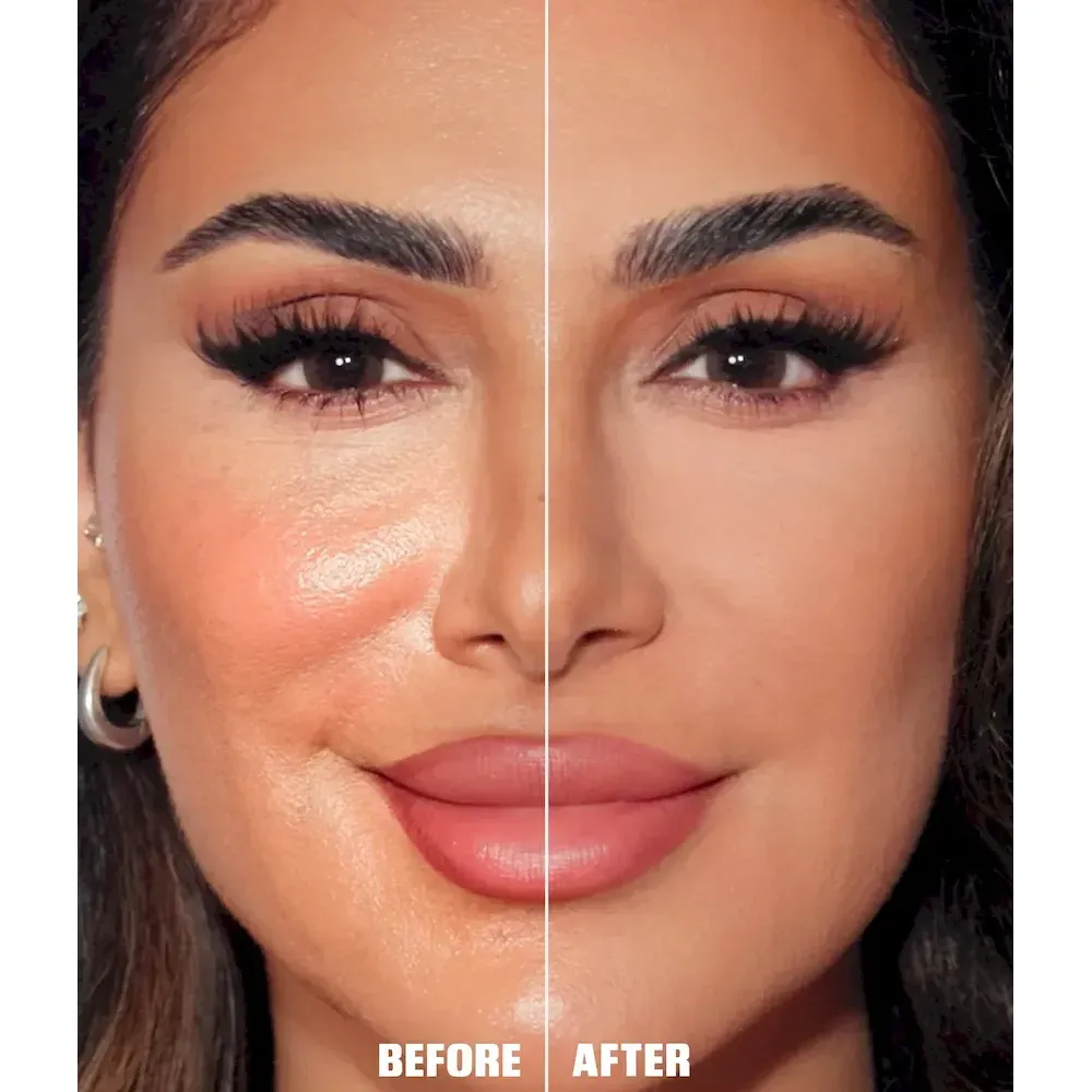 THE ULTIMATE UNDER EYE ROUTINE - Image 2